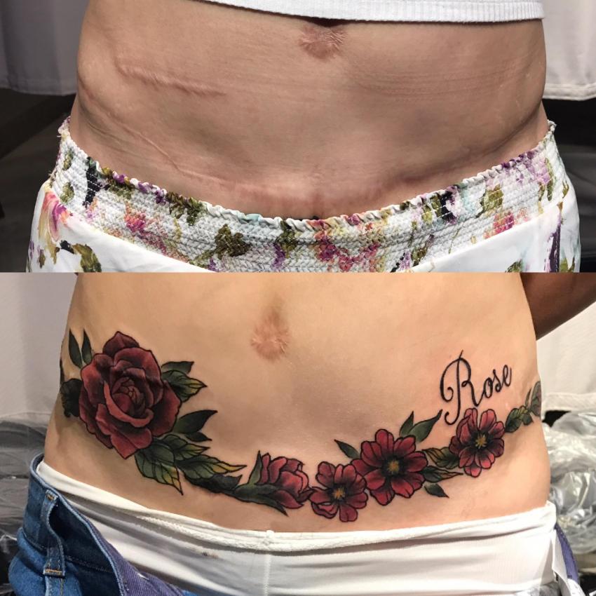 C-section tattoos: mums reveal caesarean scar body art | MadeForMums
