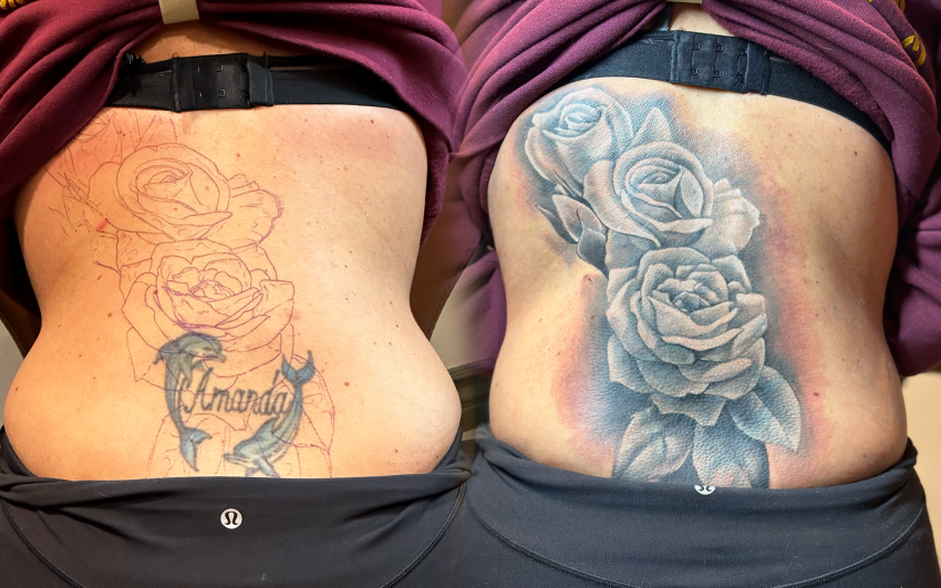 Tattoo Removal For Cover Up Tattoos | Laser Tattoo Removal